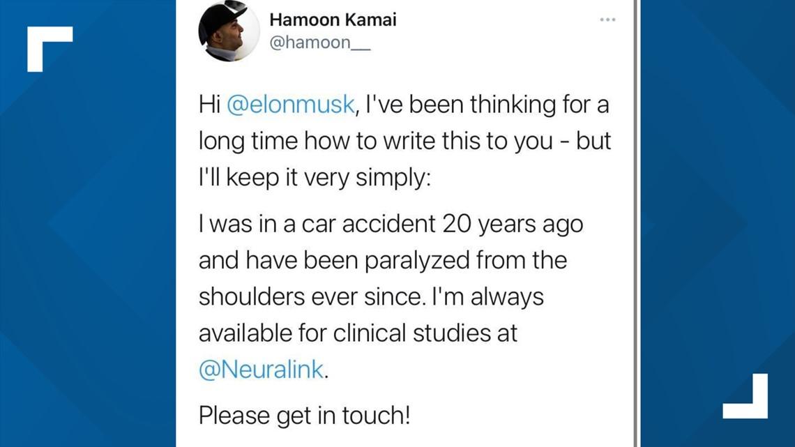 Tesla Model 2 Elon Musk says Neuralink could start human trials by the end of the year 667fad2d-e0bc-49a7-a43d-3744e681af4d_1140x641